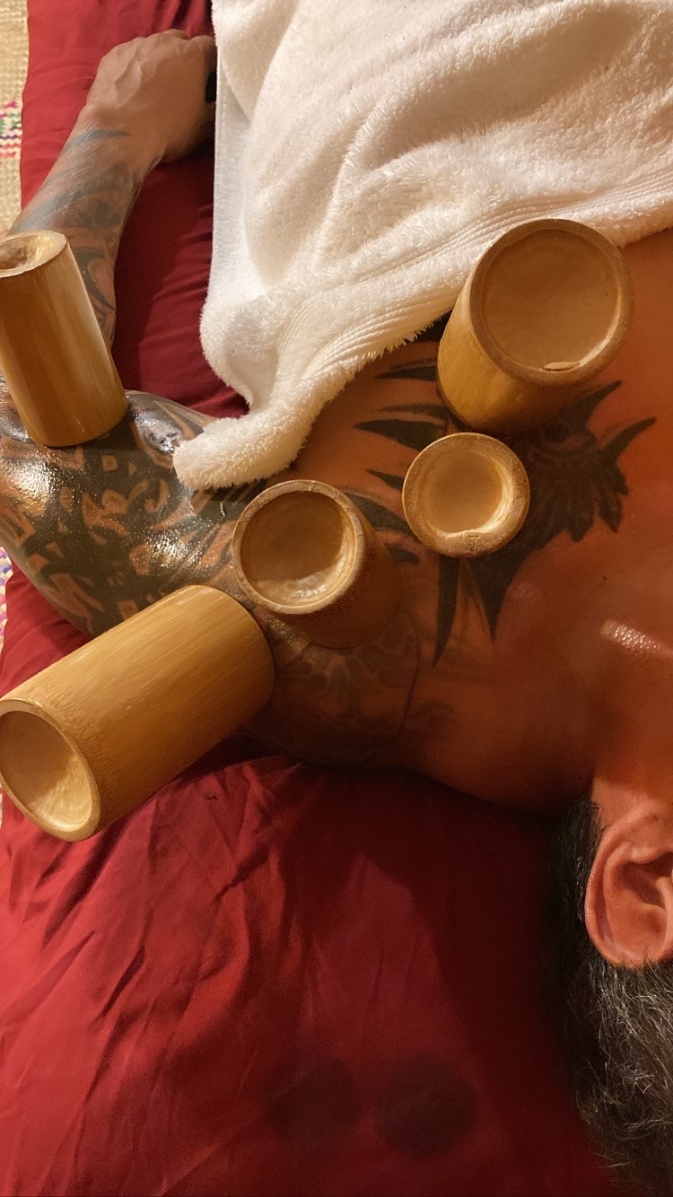Person lying on bed with multiple wooden cups on their chest and arm, partially covered by a white towel.