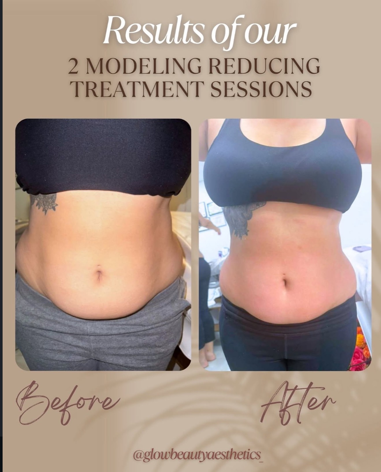 Side-by-side comparison of a person's abdomen before and after treatment sessions, showing reduction in abdominal size.