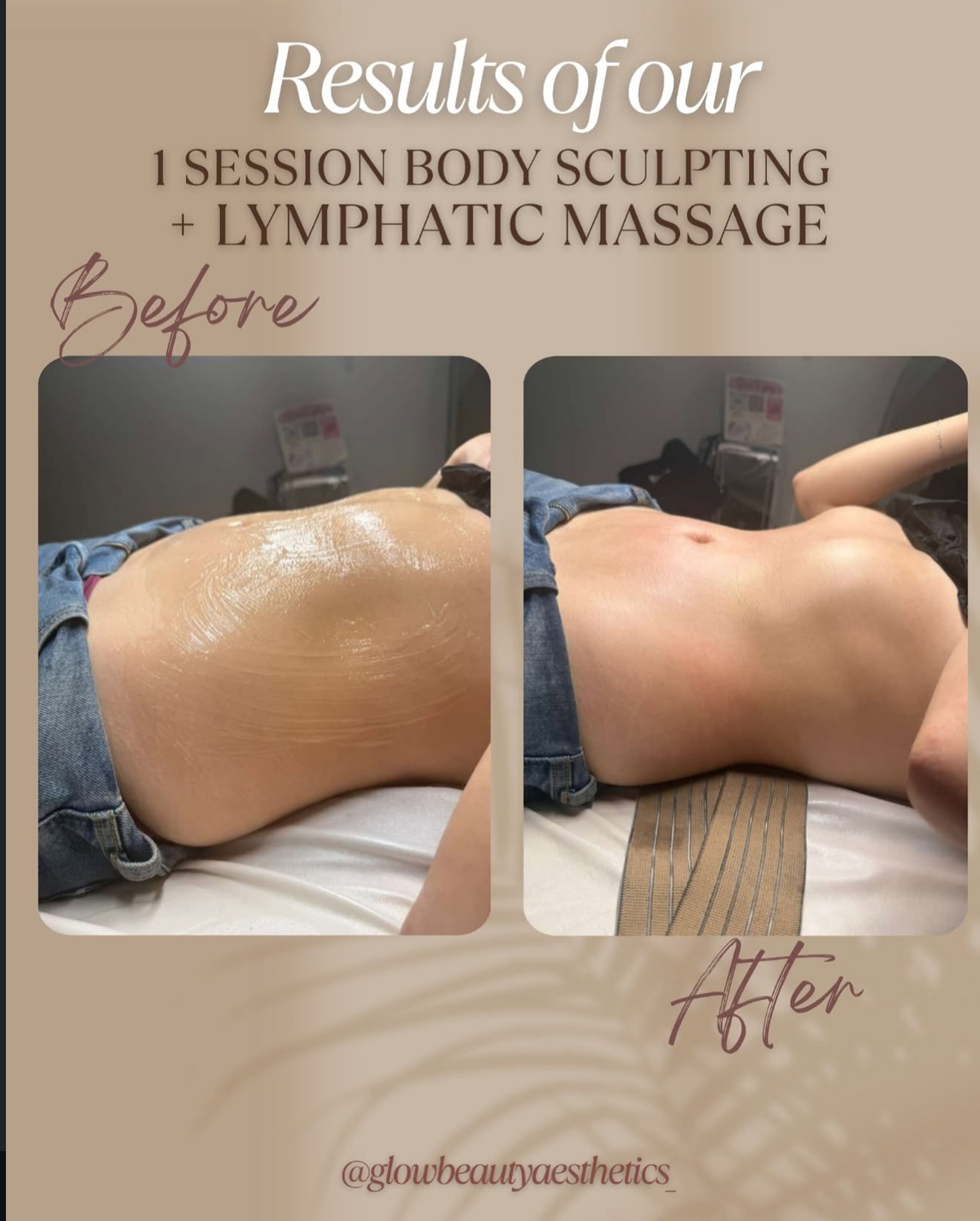 Side-by-side images showing a person's back before and after body sculpting and massage treatment.