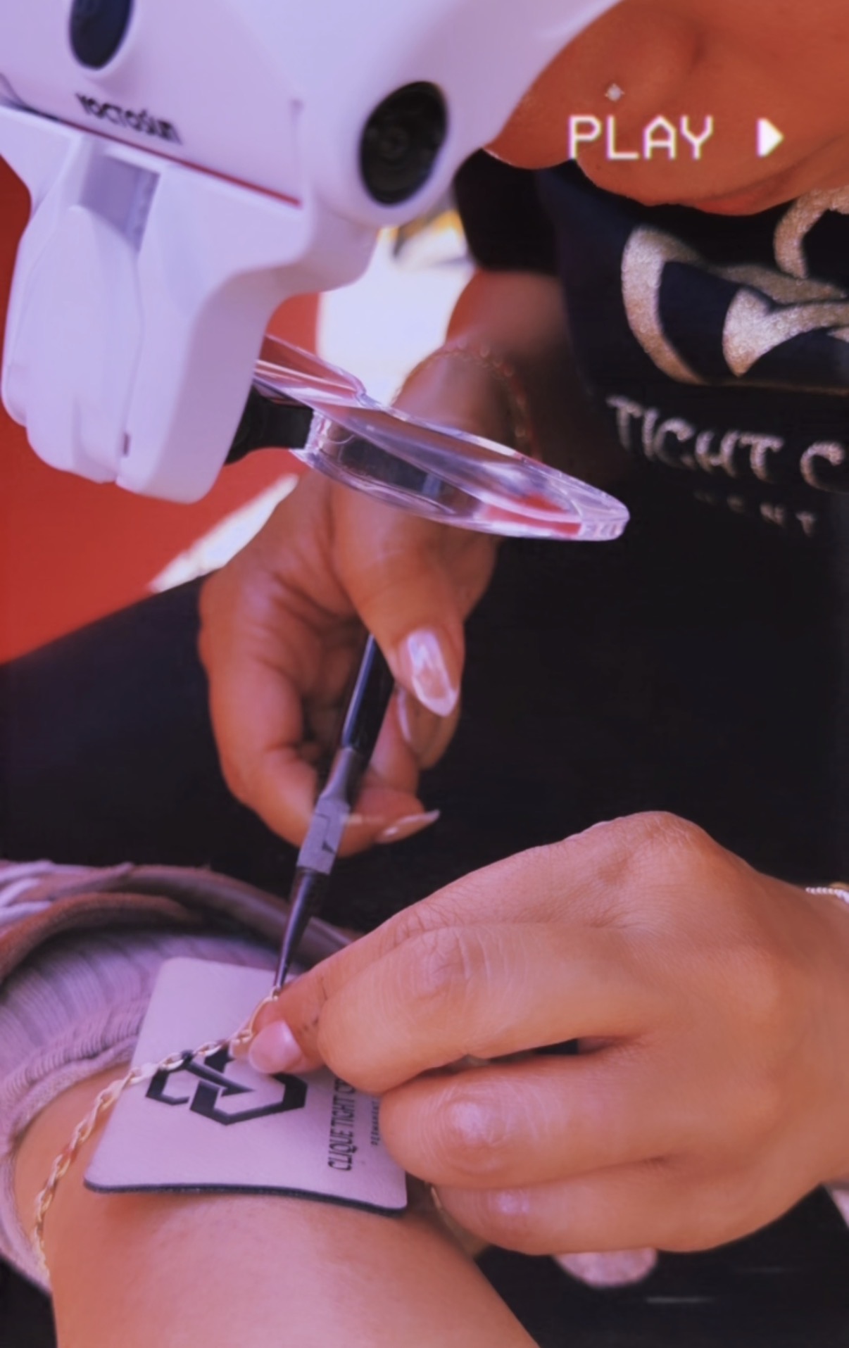 Person using a medical device on a patient's skin, holding a small tool, with a label visible.