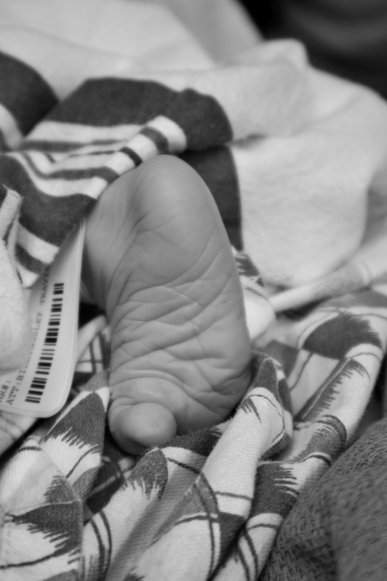 Close-up of a baby's foot resting on a patterned blanket, with medical tags nearby.