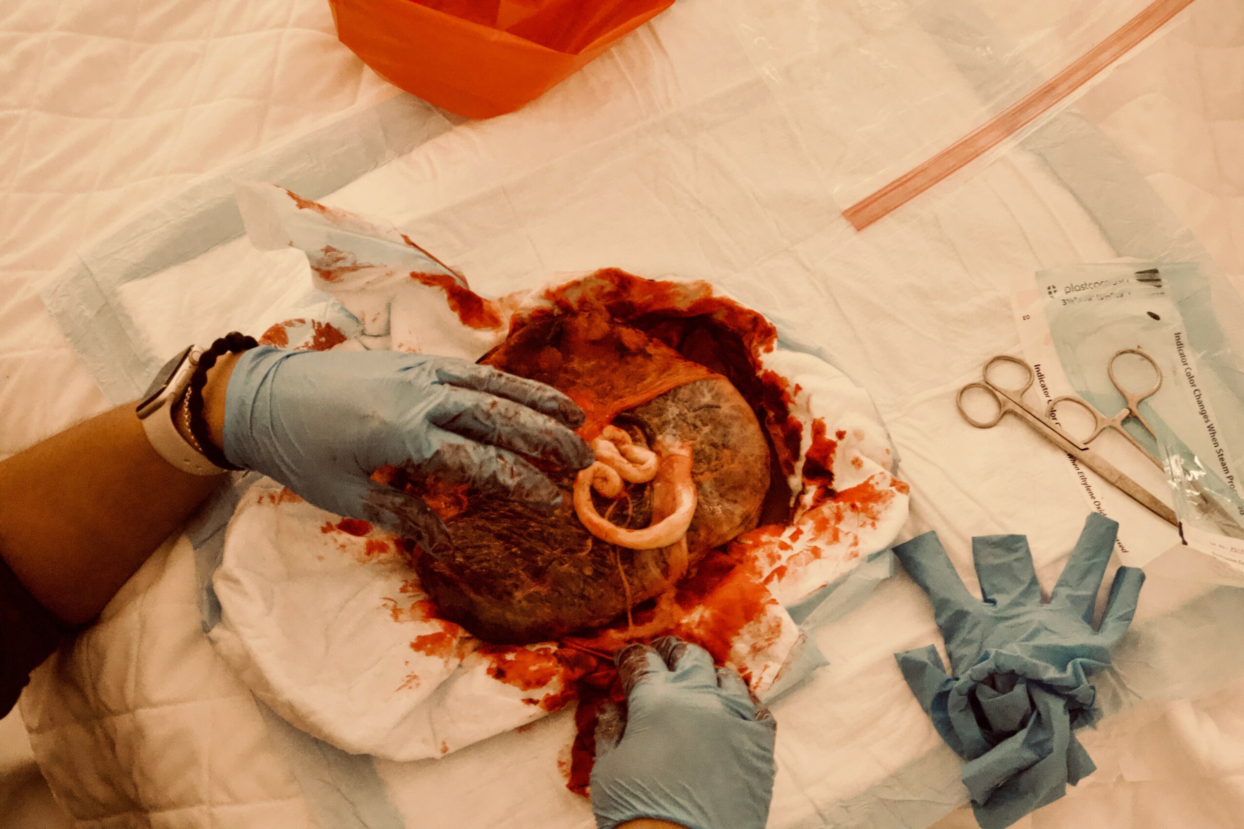 Medical procedure with gloves, surgical tools, and a wound on a person's abdomen, showing a medical setting.