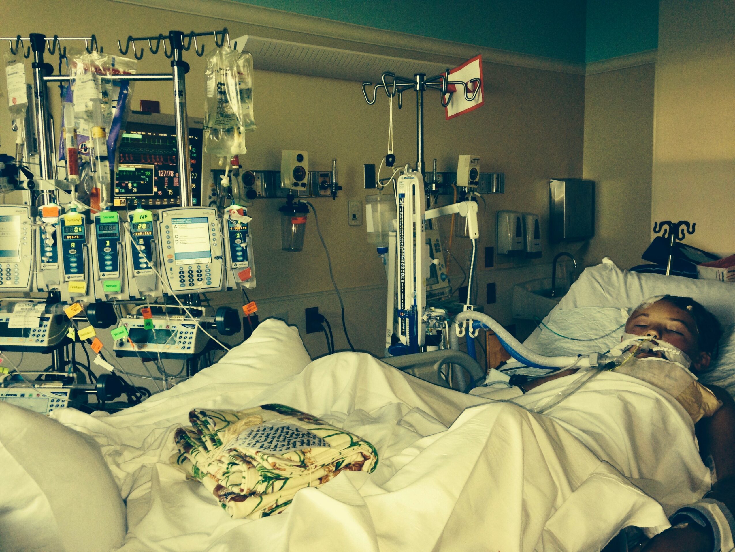 Patient lying in hospital bed connected to medical equipment, with IVs and monitors around, in a hospital room.