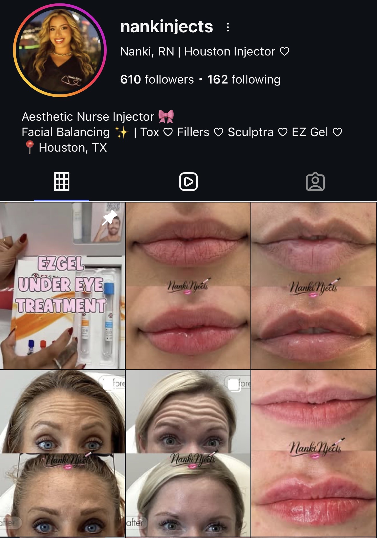 Social media profile of aesthetic nurse injector with images of lip and eyebrow treatments, and a close-up of eyes and lips.