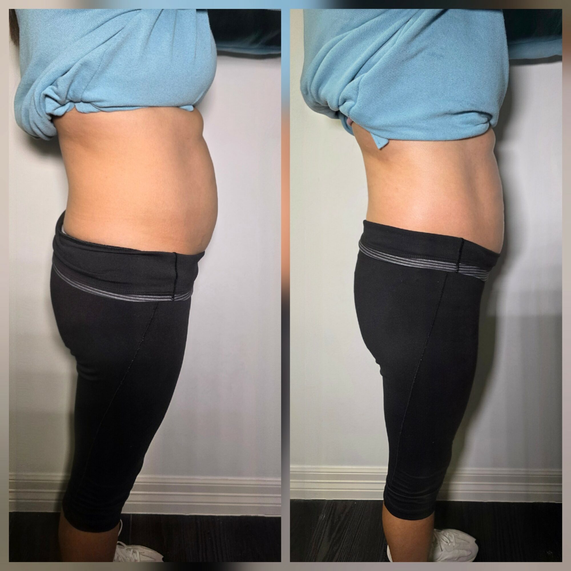 Side view of a person before and after weight loss, showing a slimmer waist in the second image.